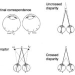 Glasses & Eye Size: Illusion vs. Reality