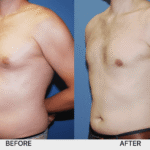 Men’s Nipple Size: Genetics, Variations & When to Seek Advice