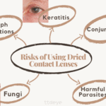 Reusing Contact Lenses: Risks & Dangers to Your Eyes