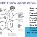 Son’s Awkward Gait? Causes & When to Seek Help