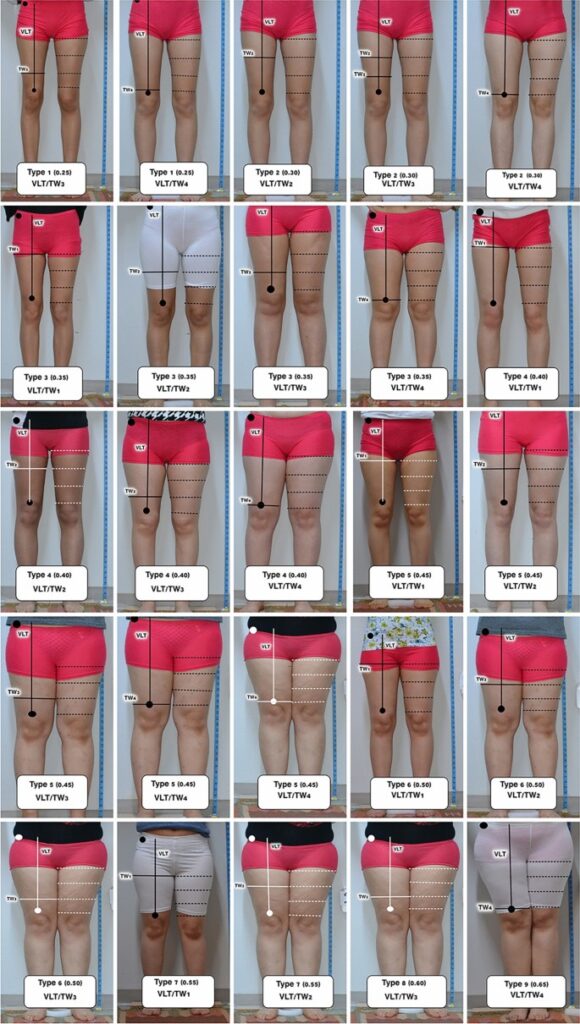 Thick Thighs: Are They Attractive? Beauty Standards Explained