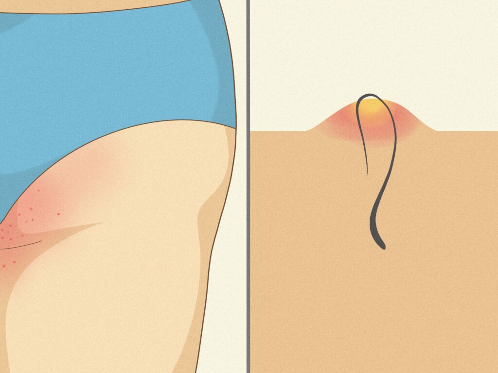 Waxing Your Buttocks: A Guide to Smooth Skin