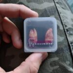 Wisdom Teeth Removal: Can Extracted Teeth Be Saved?